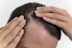 adult-male-looking-his-hair-scaled.jpg